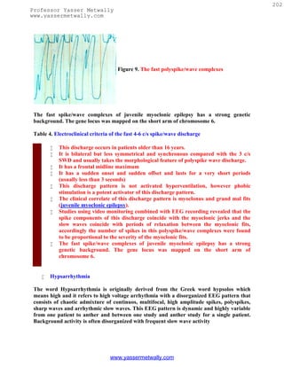 202
Professor Yasser Metwally
www.yassermetwally.com




                                      Figure 9. The fast polyspike/wave complexes




 The fast spike/wave complexes of juvenile myoclonic epilepsy has a strong genetic
 background. The gene locus was mapped on the short arm of chromosome 6.

 Table 4. Electroclinical criteria of the fast 4-6 c/s spike/wave discharge

           This discharge occurs in patients older than 16 years.
           It is bilateral but less symmetrical and synchronous compared with the 3 c/s
            SWD and usually takes the morphological feature of polyspike wave discharge.
           It has a frontal midline maximum
           It has a sudden onset and sudden offset and lasts for a very short periods
            (usually less than 3 seconds)
           This discharge pattern is not activated hyperventilation, however phobic
            stimulation is a potent activator of this discharge pattern.
           The clinical correlate of this discharge pattern is myoclonus and grand mal fits
            (juvenile myoclonic epilepsy).
           Studies using video monitoring combined with EEG recording revealed that the
            spike components of this discharge coincide with the myoclonic jerks and the
            slow waves coincide with periods of relaxation between the myoclonic fits,
            accordingly the number of spikes in this polyspike/wave complexes were found
            to be proportional to the severity of the myoclonic fits.
           The fast spike/wave complexes of juvenile myoclonic epilepsy has a strong
            genetic background. The gene locus was mapped on the short arm of
            chromosome 6.


       Hypsarrhythmia

 The word Hypsarrhythmia is originally derived from the Greek word hypsolos which
 means high and it refers to high voltage arrhythmia with a disorganized EEG pattern that
 consists of chaotic admixture of continuos, multifocal, high amplitude spikes, polyspikes,
 sharp waves and arrhythmic slow waves. This EEG pattern is dynamic and highly variable
 from one patient to anther and between one study and anther study for a single patient.
 Background activity is often disorganized with frequent slow wave activity




                                   www.yassermetwally.com
 