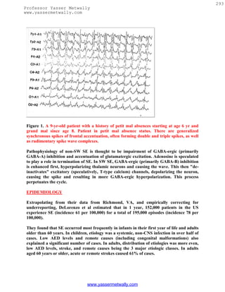 293
Professor Yasser Metwally
www.yassermetwally.com




 Figure 1. A 9-yr-old patient with a history of petit mal absences starting at age 6 yr and
 grand mal since age 8. Patient in petit mal absence status. There are generalized
 synchronous spikes of frontal accentuation, often forming double and triple spikes, as well
 as rudimentary spike wave complexes.

 Pathophysiology of non-SW SE is thought to be impairment of GABA-ergic (primarily
 GABA-A) inhibition and accentuation of glutamatergic excitation. Adenosine is speculated
 to play a role in termination of SE. In SW SE, GABA-ergic (primarily GABA-B) inhibition
 is enhanced first, hyperpolarizing thalamic neurons and causing the wave. This then "de-
 inactivates" excitatory (speculatively, T-type calcium) channels, depolarizing the neuron,
 causing the spike and resulting in more GABA-ergic hyperpolarization. This process
 perpetuates the cycle.

 EPIDEMIOLOGY

 Extrapolating from their data from Richmond, VA, and empirically correcting for
 underreporting, DeLorenzo et al estimated that in 1 year, 152,000 patients in the US
 experience SE (incidence 61 per 100,000) for a total of 195,000 episodes (incidence 78 per
 100,000).

 They found that SE occurred most frequently in infants in their first year of life and adults
 older than 60 years. In children, etiology was a systemic, non-CNS infection in over half of
 cases. Low AED levels and remote causes (including congenital malformations) also
 explained a significant number of cases. In adults, distribution of etiologies was more even,
 low AED levels, stroke, and remote causes being the 3 major etiologic classes. In adults
 aged 60 years or older, acute or remote strokes caused 61% of cases.




                                 www.yassermetwally.com
 