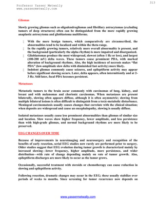 313
Professor Yasser Metwally
www.yassermetwally.com


 Gliomas

 Slowly growing gliomas such as oligodendrogliomas and fibrillary astrocytomas (excluding
 tumors of deep structures) often can be distinguished from the more rapidly growing
 anaplastic astrocytoma and glioblastoma multiforme.

       With the more benign tumors, which comparatively are circumscribed, the
        abnormalities tend to be localized and within the theta range.
       In the rapidly growing tumors, relatively more overall abnormality is present, and
        the background (particularly the alpha rhythm) is more impaired and disorganized.
       Glioblastomas produce the most widespread, slowest (often 1 Hz or less), and largest
        (100-200 mV) delta waves. These tumors cause prominent PDA, with marked
        alteration of background rhythms. Also, the high incidence of necrosis makes “flat
        PDA” (low-amplitude slow delta with diminished fast activity) more likely.
       Indolent gliomas commonly cause seizures, and epileptiform activity may appear
        before significant slowing occurs. Later, delta appears, often intermittently and at 2-
        3 Hz. Still later, focal PDA becomes persistent.

 Metastases

 Metastatic tumors to the brain occur commonly with carcinomas of lung, kidney, and
 breast and with melanomas and chorionic carcinomas. When metastases are present
 bilaterally, slowing often appears diffuse, although it is often asymmetric; slowing from
 multiple bilateral lesions is often difficult to distinguish from a toxic-metabolic disturbance.
 Meningeal carcinomatosis usually causes changes that correlate with the clinical situation;
 when deposits are widespread and cause an encephalopathy, slowing is usually diffuse.

 Isolated metastases usually cause less prominent abnormalities than gliomas of similar size
 and location. Slow waves show higher frequency, lower amplitude, and less persistence
 than with high-grade gliomas, and normal background rhythms are more likely to be
 preserved.

 EEG CHANGES OVER TIME

 Because of improvements in neuroimaging and neurosurgery and recognition of the
 benefits of early resection, serial EEG studies now rarely are performed prior to surgery.
 Older studies suggest that EEG evolution during tumor growth is characterized mainly by
 increased slowing—lower frequency, higher amplitude, more persistence, and wider
 distribution—with rate of change depending mainly on rate of tumor growth. Also,
 epileptiform discharges are more likely to occur as the tumor grows.

 Occasionally, successful treatment with steroids or chemotherapy can cause reduction in
 slowing and epileptiform activity.

 Following resection, dramatic changes may occur in the EEG; these usually stabilize over
 periods of weeks to months. Since screening for tumor recurrence now depends on




                                  www.yassermetwally.com
 