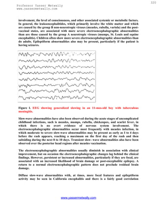 320
Professor Yasser Metwally
www.yassermetwally.com


 involvement, the level of consciousness, and other associated systemic or metabolic factors.
 In general, the leukoencephalitides, which primarily involve the white matter and which
 are caused by the group B non-neurotropic viruses (measles, rubella, variola) and the post-
 vaccinal states, are associated with more severe electroencephalographic abnormalities
 than are those caused by the group A neurotropic viruses (mumps, St. Louis and equine
 encephalitis). Children often show more severe electroencephalographic abnormalities than
 do adults. Epileptiform abnormalities also may be present, particularly if the patient is
 having seizures.




 Figure l. EEG showing generalized slowing in an 11-mos-old boy with tuberculous
 meningitis.

 Slow-wave abnormalities have also been observed during the acute stages of uncomplicated
 childhood infections, such is measles, mumps, rubella, chickenpox, and scarlet fever, in
 which there is no overt evidence of nervous system involvement. The
 electroencephalographic abnormalities occur most frequently with measles infection, in
 which moderate to severe slow-wave abnormalities may be present as early as I to 4 days
 before the rash appears, reaching a maximum on the first day of the rash and then
 subsiding during the next 8 to 10 days. Transient slow- wave abnormalities also have been
 observed over the posterior head regions after measles vaccination.

 The electroencephalographic abnormalities usually diminish in association with clinical
 improvement, but on occasion the electroencephalographic changes lag behind the clinical
 findings. However, persistent or increased abnormalities, particularly if they are focal, are
 associated with an increased likelihood of brain damage or post-encephalitic epilepsy. A
 return to a normal electroencephalographic pattern does not preclude residual brain
 damage.

 Diffuse slow-wave abnormalities with, at times, more focal features and epileptiform
 activity may be seen in California encephalitis and there is a fairly good correlation




                                 www.yassermetwally.com
 