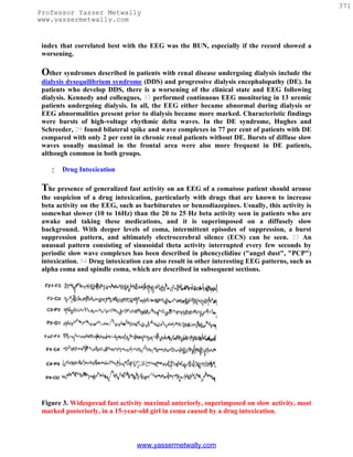 371
Professor Yasser Metwally
www.yassermetwally.com


 index that correlated best with the EEG was the BUN, especially if the record showed a
 worsening.

 Other syndromes described in patients with renal disease undergoing dialysis include the
 dialysis dysequilibrium syndrome (DDS) and progressive dialysis encephalopathy (DE). In
 patients who develop DDS, there is a worsening of the clinical state and EEG following
 dialysis. Kennedy and colleagues, 33 performed continuous EEG monitoring in 13 uremic
 patients undergoing dialysis. In all, the EEG either became abnormal during dialysis or
 EEG abnormalities present prior to dialysis became more marked. Characteristic findings
 were bursts of high-voltage rhythmic delta waves. In the DE syndrome, Hughes and
 Schreeder, 29 found bilateral spike and wave complexes in 77 per cent of patients with DE
 compared with only 2 per cent in chronic renal patients without DE. Bursts of diffuse slow
 waves usually maximal in the frontal area were also more frequent in DE patients,
 although common in both groups.

       Drug Intoxication

 The presence of generalized fast activity on an EEG of a comatose patient should arouse
 the suspicion of a drug intoxication, particularly with drugs that are known to increase
 beta activity on the EEG, such as barbiturates or benzodiazepines. Usually, this activity is
 somewhat slower (10 to 16Hz) than the 20 to 25 Hz beta activity seen in patients who are
 awake and taking these medications, and it is superimposed on a diffusely slow
 background. With deeper levels of coma, intermittent episodes of suppression, a burst
 suppression pattern, and ultimately electrocerebral silence (ECS) can be seen. 23 An
 unusual pattern consisting of sinusoidal theta activity interrupted every few seconds by
 periodic slow wave complexes has been described in phencyclidine ("angel dust", "PCP")
 intoxication. 54 Drug intoxication can also result in other interesting EEG patterns, such as
 alpha coma and spindle coma, which are described in subsequent sections.




 Figure 3. Widespread fast activity maximal anteriorly, superimposed on slow activity, most
 marked posteriorly, in a 15-year-old girl in coma caused by a drug intoxication.



                                 www.yassermetwally.com
 