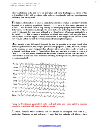 377
Professor Yasser Metwally
www.yassermetwally.com


 either arrhythmic spike and wave or polyspike and wave discharges or. bursts of fast
 activity (10 to 20 Hz) with occasional spike and wave or polyspike and wave complexes and
 a diffusely slow background.

 The behavioral alterations in absence status have sometimes resulted in an incorrect initial
 diagnosis of a primary psychiatric disorder, 58,59 such as depression, psychosis, or
 hysteria. There are often clues to help identify the underlying epileptic nature of this acute
 disturbance. Most commonly, the episodes occur in known epileptic patients (90 to 95 per
 cent), 19 although they can occur although a previous history of seizures, particularly in
 the elderly. 17,19 The presence of associated myoclonic movements, such as eyelid flutter
 and rhythmic facial or upper extremity movements, is also suggestive of absence status.
 However, an EEG is the only laboratory means of verifying the diagnosis.

 Other entities in the differential diagnosis include the postictal state, drug intoxication,
 transient global amnesia, and complex partial status epilepticus (CPSE). In adults, complex
 partial seizures are more frequent than absence seizures, but they rarely present as a
 prolonged confusional state. 40 Nevertheless, there have recently been several reports of
 CPSE 5,48,55 in both adults and children. In contrast to absence status, in CPSE, the EEG
 abnormalities usually are focal, most often affecting the temporal area, although they can
 become generalized.




 Figure 6. Continuous generalized spike and polyspike and wave activity, maximal
 anteriorly, in a 60-year-old woman in absence status.

 At  times, however, these conditions can be difficult to distinguish even with EEG
 monitoring. Niedermeyer and colleagues 42 described two patients with absence status




                                  www.yassermetwally.com
 