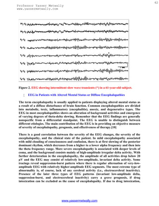 42
Professor Yasser Metwally
www.yassermetwally.com




 Figure 2. EEG showing intermittent slow wave transients (*) in a 61-year-old subject.

       EEG in Patients with Altered Mental Status or Diffuse Encephalopathies

 The term encephalopathy is usually applied to patients displaying altered mental status as
 a result of a diffuse disturbance of brain function. Common encephalopathies are divided
 into metabolic, toxic, inflammatory (encephalitis), anoxic, and degenerative types. The
 EEG in most encephalopathies shows an alteration of background activities and emergence
 of varying degrees of theta-delta slowing. Remember that the EEG findings are generally
 nonspecific from a differential standpoint. The EEG is unable to distinguish between
 different etiologies. The main contribution of the EEG is in providing an objective measure
 of severity of encephalopathy, prognosis, and effectiveness of therapy.[10]

 There is a good correlation between the severity of the EEG changes, the severity of the
 encephalopathy, and the clinical state of the patient. In mild encephalopathy associated
 with mild clouding of consciousness and confusion, there is at first slowing of the posterior
 dominant rhythm, which decreases from a higher to a lower alpha frequency and then into
 the theta frequency range. More severe encephalopathy is associated with deeper levels of
 coma, and the background consists mainly of high-amplitude irregular delta activity. With
 further deterioration in the encephalopathy, the amplitude of all activities drop below 20
 µV and the EEG may consist of relatively low-amplitude, invariant delta activity. Some
 tracings reveal suppression-burst pattern where there is regular alternation of very-low-
 amplitude EEG with relatively higher-amplitude EEG segments. The most extreme type of
 abnormality is, of course, lack of any cerebral activity (i.e., electrocerebral inactivity).
 Presence of the later three types of EEG patterns (invariant low-amplitude delta,
 suppression-burst, and electrocerebral inactivity) carry a grave prognosis, if drug
 intoxication can be excluded as the cause of encephalopathy. If due to drug intoxication,




                                 www.yassermetwally.com
 