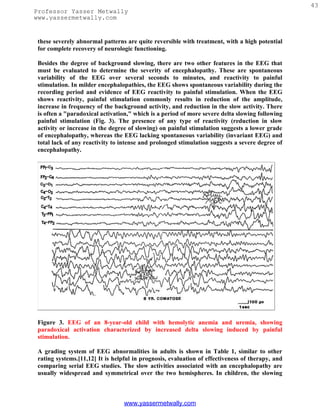 43
Professor Yasser Metwally
www.yassermetwally.com


 these severely abnormal patterns are quite reversible with treatment, with a high potential
 for complete recovery of neurologic functioning.

 Besides the degree of background slowing, there are two other features in the EEG that
 must be evaluated to determine the severity of encephalopathy. These are spontaneous
 variability of the EEG over several seconds to minutes, and reactivity to painful
 stimulation. In milder encephalopathies, the EEG shows spontaneous variability during the
 recording period and evidence of EEG reactivity to painful stimulation. When the EEG
 shows reactivity, painful stimulation commonly results in reduction of the amplitude,
 increase in frequency of the background activity, and reduction in the slow activity. There
 is often a "paradoxical activation," which is a period of more severe delta slowing following
 painful stimulation (Fig. 3). The presence of any type of reactivity (reduction in slow
 activity or increase in the degree of slowing) on painful stimulation suggests a lower grade
 of encephalopathy, whereas the EEG lacking spontaneous variability (invariant EEG) and
 total lack of any reactivity to intense and prolonged stimulation suggests a severe degree of
 encephalopathy.




 Figure 3. EEG of an 8-year-old child with hemolytic anemia and uremia, showing
 paradoxical activation characterized by increased delta slowing induced by painful
 stimulation.

 A grading system of EEG abnormalities in adults is shown in Table 1, similar to other
 rating systems.[11,12] It is helpful in prognosis, evaluation of effectiveness of therapy, and
 comparing serial EEG studies. The slow activities associated with an encephalopathy are
 usually widespread and symmetrical over the two hemispheres. In children, the slowing



                                  www.yassermetwally.com
 