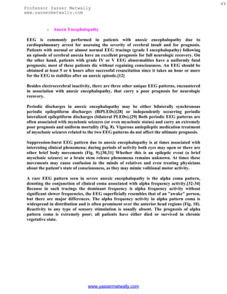 49
Professor Yasser Metwally
www.yassermetwally.com


           o   Anoxic Encephalopathy

 EEG is commonly performed in patients with anoxic encephalopathy due to
 cardiopulmonary arrest for assessing the severity of cerebral insult and for prognosis.
 Patients with normal or almost normal EEG tracings (grade I encephalopathy) following
 an episode of cerebral anoxia have an excellent prognosis for full neurologic recovery. On
 the other hand, patients with grade IV or V EEG abnormalities have a uniformly fatal
 prognosis; most of these patients die without regaining consciousness. An EEG should be
 obtained at least 5 or 6 hours after successful resuscitation since it takes an hour or more
 for the EEG to stabilize after an anoxic episode.[12]

 Besides electrocerebral inactivity, there are three other unique EEG patterns, encountered
 in association with anoxic encephalopathy, that carry a poor prognosis for neurologic
 recovery.

 Periodic discharges in anoxic encephalopathy may be either bilaterally synchronous
 periodic epileptiform discharges (BiPLEDs)[28] or independently occurring periodic
 lateralized epileptiform discharges (bilateral PLEDs).[29] Both periodic EEG patterns are
 often associated with myoclonic seizures (or even myoclonic status) and carry an extremely
 poor prognosis and uniform mortality (Fig. 8). Vigorous antiepileptic medication treatment
 of myoclonic seizures related to the two EEG patterns do not affect the ultimate prognosis.

 Suppression-burst EEG pattern due to anoxic encephalopathy is at times associated with
 interesting clinical phenomena; during periods of activity both eyes may open or there are
 other brief body movements (Fig. 9).[30,31] Whether this is an epileptic event (a brief
 myoclonic seizure) or a brain stem release phenomena remains unknown. At times these
 movements may cause confusion in the minds of relatives and even treating physicians
 about the patient's state of consciousness, as they may mimic volitional motor activity.

 A rare EEG pattern seen in severe anoxic encephalopathy is the alpha coma pattern,
 denoting the conjunction of clinical coma associated with alpha frequency activity.[32-34]
 Because in such tracings the dominant frequency is alpha frequency activity without
 significant slower frequencies, the EEG superficially resembles that of an "awake" person,
 but there are major differences. The alpha frequency activity in alpha pattern coma is
 widespread in distribution and is often prominent over the anterior head regions (Fig. 10).
 Reactivity to any type of sensory stimulation is usually absent. The prognosis of alpha
 pattern coma is extremely poor; all patients have either died or survived in chronic
 vegetative state.




                                 www.yassermetwally.com
 