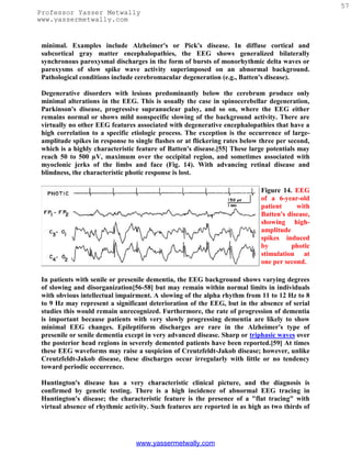 57
Professor Yasser Metwally
www.yassermetwally.com


 minimal. Examples include Alzheimer's or Pick's disease. In diffuse cortical and
 subcortical gray matter encephalopathies, the EEG shows generalized bilaterally
 synchronous paroxysmal discharges in the form of bursts of monorhythmic delta waves or
 paroxysms of slow spike wave activity superimposed on an abnormal background.
 Pathological conditions include cerebromacular degeneration (e.g., Batten's disease).

 Degenerative disorders with lesions predominantly below the cerebrum produce only
 minimal alterations in the EEG. This is usually the case in spinocerebellar degeneration,
 Parkinson's disease, progressive supranuclear palsy, and so on, where the EEG either
 remains normal or shows mild nonspecific slowing of the background activity. There are
 virtually no other EEG features associated with degenerative encephalopathies that have a
 high correlation to a specific etiologic process. The exception is the occurrence of large-
 amplitude spikes in response to single flashes or at flickering rates below three per second,
 which is a highly characteristic feature of Batten's disease.[55] These large potentials may
 reach 50 to 500 µV, maximum over the occipital region, and sometimes associated with
 myoclonic jerks of the limbs and face (Fig. 14). With advancing retinal disease and
 blindness, the characteristic photic response is lost.

                                                                             Figure 14. EEG
                                                                             of a 6-year-old
                                                                             patient     with
                                                                             Batten's disease,
                                                                             showing high-
                                                                             amplitude
                                                                             spikes induced
                                                                             by        photic
                                                                             stimulation at
                                                                             one per second.

 In patients with senile or presenile dementia, the EEG background shows varying degrees
 of slowing and disorganization[56-58] but may remain within normal limits in individuals
 with obvious intellectual impairment. A slowing of the alpha rhythm from 11 to 12 Hz to 8
 to 9 Hz may represent a significant deterioration of the EEG, but in the absence of serial
 studies this would remain unrecognized. Furthermore, the rate of progression of dementia
 is important because patients with very slowly progressing dementia are likely to show
 minimal EEG changes. Epileptiform discharges are rare in the Alzheimer's type of
 presenile or senile dementia except in very advanced disease. Sharp or triphasic waves over
 the posterior head regions in severely demented patients have been reported.[59] At times
 these EEG waveforms may raise a suspicion of Creutzfeldt-Jakob disease; however, unlike
 Creutzfeldt-Jakob disease, these discharges occur irregularly with little or no tendency
 toward periodic occurrence.

 Huntington's disease has a very characteristic clinical picture, and the diagnosis is
 confirmed by genetic testing. There is a high incidence of abnormal EEG tracing in
 Huntington's disease; the characteristic feature is the presence of a "flat tracing" with
 virtual absence of rhythmic activity. Such features are reported in as high as two thirds of




                                 www.yassermetwally.com
 