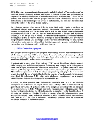 69
Professor Yasser Metwally
www.yassermetwally.com


 EEG. Therefore, absence of such changes during a clinical episode of "unconsciousness" or
 bilateral widespread motor activity (resembling grand mal seizure) can be particularly
 important in making the diagnosis of nonepileptic events or pseudoseizures. Ten to 20% of
 patients with pseudoseizures do have epileptic seizures as well. The most one can say is that
 at least some of the clinical episodes appear to be functional, and this must be considered
 within the context of the entire clinical picture.

 In evaluating patients with muscle jerks or other brief motor events, it needs to be
 established whether these represent epileptic phenomena. Simultaneous recording by
 placing two electrodes over the involved muscle may be very helpful in establishing the
 relationship of, or lack of, the EEG and the motor recordings. In patients with myoclonic
 seizures, it is not always easy to establish whether an electrical event synchronous with the
 motor jerk is indeed a cerebral discharge or simply a movement artifact. The presence of
 morphologically similar EEG discharges in other portions of the tracing but unassociated
 with obvious motor activity will establish that they represent a genuine cortical discharge
 rather than an artifact generated by sudden movement.

       EEG in Generalized Epilepsies

 The epileptic process in generalized epilepsies involves large areas of the brain at the outset
 of the seizure, and the EEG is characterized by bilaterally synchronous generalized
 paroxysms of spikes and spike wave discharges. Generalized epilepsies are subcategorized
 as primary (idiopathic) and secondary (symptomatic).

 A patient with primary generalized epilepsy (PGE) has no identifiable etiology, normal
 brain imaging, and normal neurocognitive functioning. The epilepsy has a strong genetic
 basis and is highly responsive to antiepileptic medication. The patient may suffer from
 absence (petit mal), myoclonic, and tonic-clonic seizures, among other generalized seizures.
 Many different syndromes of PGE have been recognized depending upon the predominant
 seizure type and the age of onset. Classically, the presence of rhythmic, anterior-dominant
 generalized bisynchronous 3 Hz spike wave discharges superimposed on a normal
 background are considered to be the EEG hallmark of PGE.

 However, the most common EEG abnormality associated with PGE is the so-called
 "irregular" or "atypical" or "rapid spike" wave activity. This is characterized by
 generalized paroxysms of spikes or spike wave complexes occurring with an irregular
 frequency of about 3 to 5 Hz. Although some spike wave complexes will approximate 3 Hz,
 the overall impression is that the EEG abnormality is much less regular than the classic 3
 Hz spike wave discharges (Fig. 21). Transient asymmetry of the bisynchronous spike wave
 activity and isolated "focal" spikes are common. Atypical generalized spike waves are not
 only seen in PGE but also in secondary generalized epilepsies such as progressive
 myoclonus epilepsies of different etiologies.




                                  www.yassermetwally.com
 