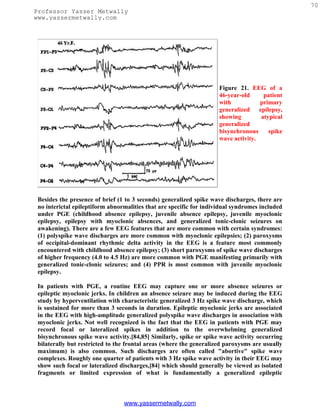 70
Professor Yasser Metwally
www.yassermetwally.com




                                                                     Figure 21. EEG of a
                                                                     46-year-old     patient
                                                                     with           primary
                                                                     generalized epilepsy,
                                                                     showing        atypical
                                                                     generalized
                                                                     bisynchronous     spike
                                                                     wave activity.




 Besides the presence of brief (1 to 3 seconds) generalized spike wave discharges, there are
 no interictal epileptiform abnormalities that are specific for individual syndromes included
 under PGE (childhood absence epilepsy, juvenile absence epilepsy, juvenile myoclonic
 epilepsy, epilepsy with myoclonic absences, and generalized tonic-clonic seizures on
 awakening). There are a few EEG features that are more common with certain syndromes:
 (1) polyspike wave discharges are more common with myoclonic epilepsies; (2) paroxysms
 of occipital-dominant rhythmic delta activity in the EEG is a feature most commonly
 encountered with childhood absence epilepsy; (3) short paroxysms of spike wave discharges
 of higher frequency (4.0 to 4.5 Hz) are more common with PGE manifesting primarily with
 generalized tonic-clonic seizures; and (4) PPR is most common with juvenile myoclonic
 epilepsy.

 In patients with PGE, a routine EEG may capture one or more absence seizures or
 epileptic myoclonic jerks. In children an absence seizure may be induced during the EEG
 study by hyperventilation with characteristic generalized 3 Hz spike wave discharge, which
 is sustained for more than 3 seconds in duration. Epileptic myoclonic jerks are associated
 in the EEG with high-amplitude generalized polyspike wave discharges in association with
 myoclonic jerks. Not well recognized is the fact that the EEG in patients with PGE may
 record focal or lateralized spikes in addition to the overwhelming generalized
 bisynchronous spike wave activity.[84,85] Similarly, spike or spike wave activity occurring
 bilaterally but restricted to the frontal areas (where the generalized paroxysms are usually
 maximum) is also common. Such discharges are often called "abortive" spike wave
 complexes. Roughly one quarter of patients with 3 Hz spike wave activity in their EEG may
 show such focal or lateralized discharges,[84] which should generally be viewed as isolated
 fragments or limited expression of what is fundamentally a generalized epileptic



                                 www.yassermetwally.com
 