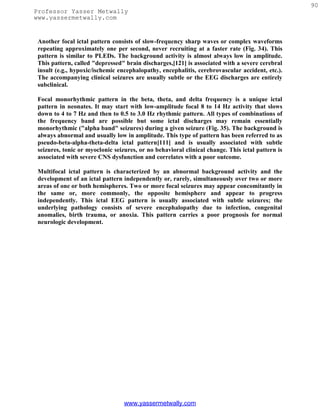 90
Professor Yasser Metwally
www.yassermetwally.com


 Another focal ictal pattern consists of slow-frequency sharp waves or complex waveforms
 repeating approximately one per second, never recruiting at a faster rate (Fig. 34). This
 pattern is similar to PLEDs. The background activity is almost always low in amplitude.
 This pattern, called "depressed" brain discharges,[121] is associated with a severe cerebral
 insult (e.g., hypoxic/ischemic encephalopathy, encephalitis, cerebrovascular accident, etc.).
 The accompanying clinical seizures are usually subtle or the EEG discharges are entirely
 subclinical.

 Focal monorhythmic pattern in the beta, theta, and delta frequency is a unique ictal
 pattern in neonates. It may start with low-amplitude focal 8 to 14 Hz activity that slows
 down to 4 to 7 Hz and then to 0.5 to 3.0 Hz rhythmic pattern. All types of combinations of
 the frequency band are possible but some ictal discharges may remain essentially
 monorhythmic ("alpha band" seizures) during a given seizure (Fig. 35). The background is
 always abnormal and usually low in amplitude. This type of pattern has been referred to as
 pseudo-beta-alpha-theta-delta ictal pattern[111] and is usually associated with subtle
 seizures, tonic or myoclonic seizures, or no behavioral clinical change. This ictal pattern is
 associated with severe CNS dysfunction and correlates with a poor outcome.

 Multifocal ictal pattern is characterized by an abnormal background activity and the
 development of an ictal pattern independently or, rarely, simultaneously over two or more
 areas of one or both hemispheres. Two or more focal seizures may appear concomitantly in
 the same or, more commonly, the opposite hemisphere and appear to progress
 independently. This ictal EEG pattern is usually associated with subtle seizures; the
 underlying pathology consists of severe encephalopathy due to infection, congenital
 anomalies, birth trauma, or anoxia. This pattern carries a poor prognosis for normal
 neurologic development.




                                  www.yassermetwally.com
 