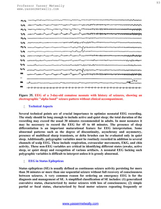 93
Professor Yasser Metwally
www.yassermetwally.com




 Figure 35. EEG of a 3-day-old comatose neonate with history of seizures, showing an
 electrographic "alpha band" seizure pattern without clinical accompaniment.

       Technical Aspects

 Several technical points are of crucial importance to optimize neonatal EEG recording.
 The study should be long enough to include active and quiet sleep; the total duration of the
 recording may exceed the usual 30 minutes recommended in adults. In most neonates it
 may be necessary to record the EEG for 45 to 60 minutes. The presence of sleep
 differentiation is an important maturational feature for EEG interpretation. Some
 abnormal patterns such as the degree of discontinuity, asynchrony and asymmetry,
 presence of multifocal sharp transients, or delta brushes can be evaluated only in quiet
 sleep. Additionally, polygraphic variables must be routinely recorded in addition to several
 channels of scalp EEG. These include respiration, extraocular movements, EKG, and chin
 activity. These non-EEG variables are critical in identifying different states (awake, active
 sleep, or quiet sleep) and recognition of various artifacts. A neonatal EEG lacking such
 polygraphic variables is difficult to interpret unless it is grossly abnormal.

       EEG in Status Epilepticus

 Status epilepticus (SE) is usually defined as continuous seizure activity persisting for more
 than 30 minutes or more than one sequential seizure without full recovery of consciousness
 between seizures. A very common reason for ordering an emergency EEG is for the
 diagnosis and management of SE. A simplified classification of SE includes: (1) generalized
 convulsive status, characterized by motor seizures with loss of consciousness; (2) simple
 partial or focal status, characterized by focal motor seizures repeating frequently or




                                 www.yassermetwally.com
 