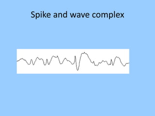 Spike and wave complex 
 