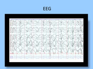 EEG 
 