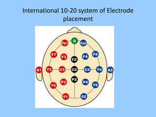 International 10-20 system of Electrode 
placement 
 