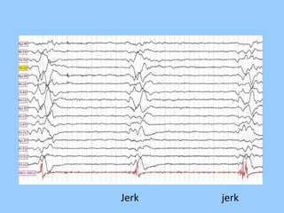 Jerk jerk 
 