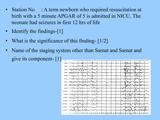 • Station No : A term newborn who required resuscitation at 
birth with a 5 minute APGAR of 5 is admitted in NICU. The 
neonate had seizures in first 12 hrs of life 
• Identify the findings-[1] 
• What is the significance of this finding- [1/2] 
• Name of the staging system other than Sarnat and Sarnat and 
give its component- [1] 
 
