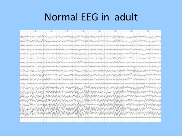 normal vs abnormal eeg