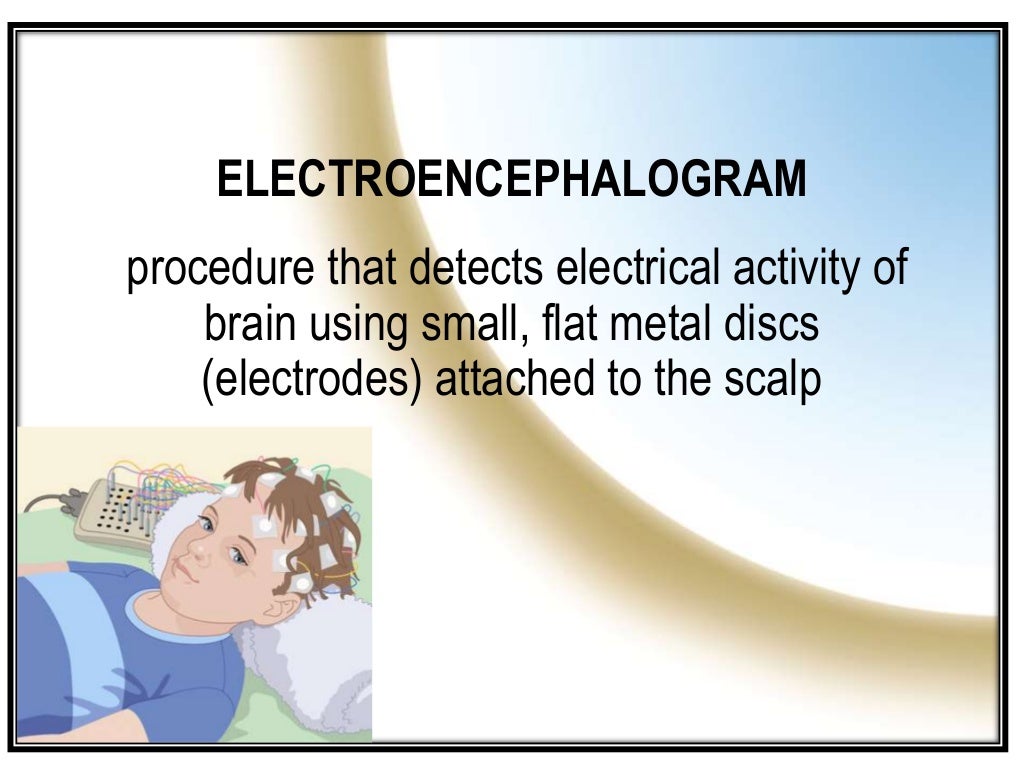 ELECTROENCEPHALOGRAM/ ELECTROENCEPHALOGRAPHY