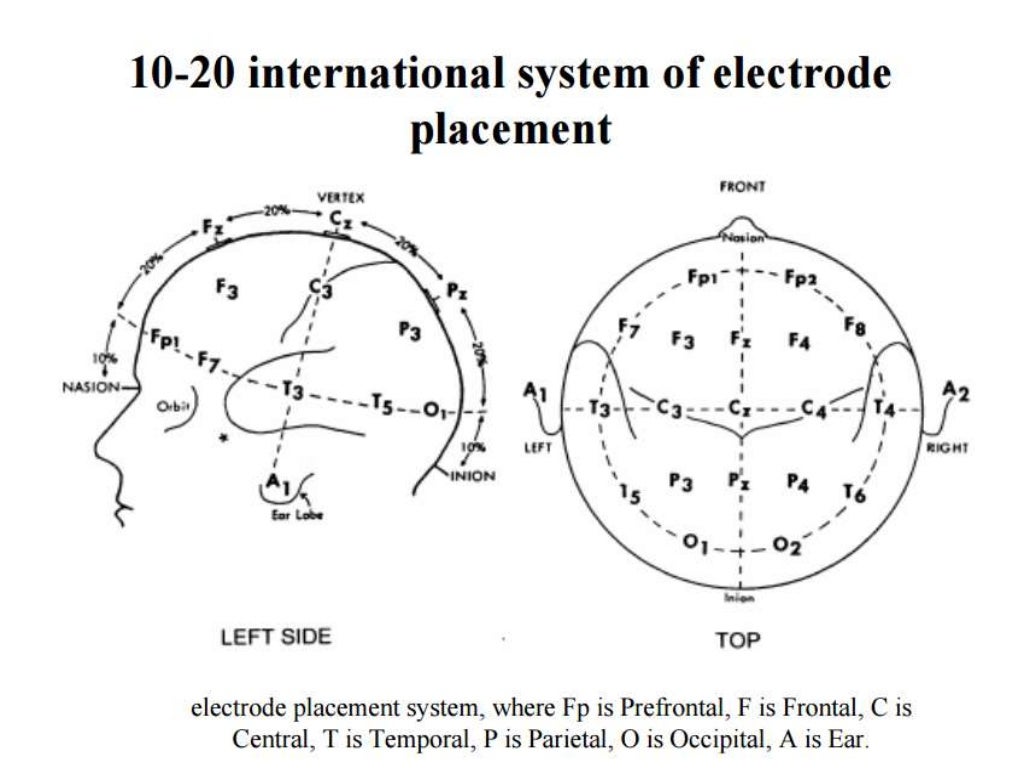 Electroencephalogram