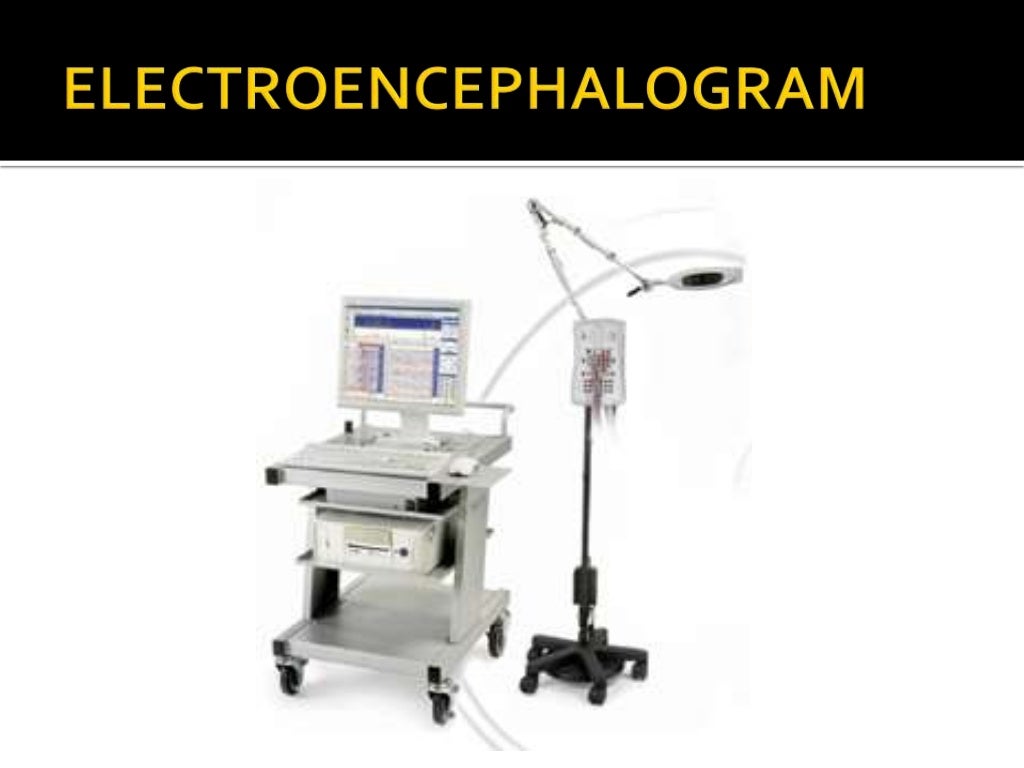 Electroencephalogram