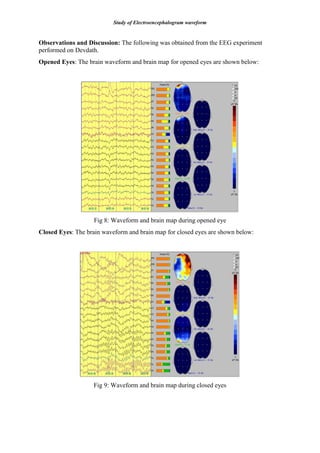 Study of Electroencephalogram waveform
Observations and Discussion: The following was obtained from the EEG experiment
performed on Devdath.
Opened Eyes: The brain waveform and brain map for opened eyes are shown below:
Fig 8: Waveform and brain map during opened eye
Closed Eyes: The brain waveform and brain map for closed eyes are shown below:
Fig 9: Waveform and brain map during closed eyes
 