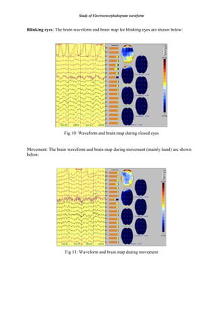 Study of Electroencephalogram waveform
Blinking eyes: The brain waveform and brain map for blinking eyes are shown below:
Fig 10: Waveform and brain map during closed eyes
Movement: The brain waveform and brain map during movement (mainly hand) are shown
below:
Fig 11: Waveform and brain map during movement
 