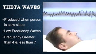 THETA WAVES
•Produced when person
is slow sleep
•Low Frequency Waves
•Frequency Greater
than 4 & less than 7
 