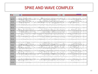 EEG in neurology and psychiatry | PPTX
