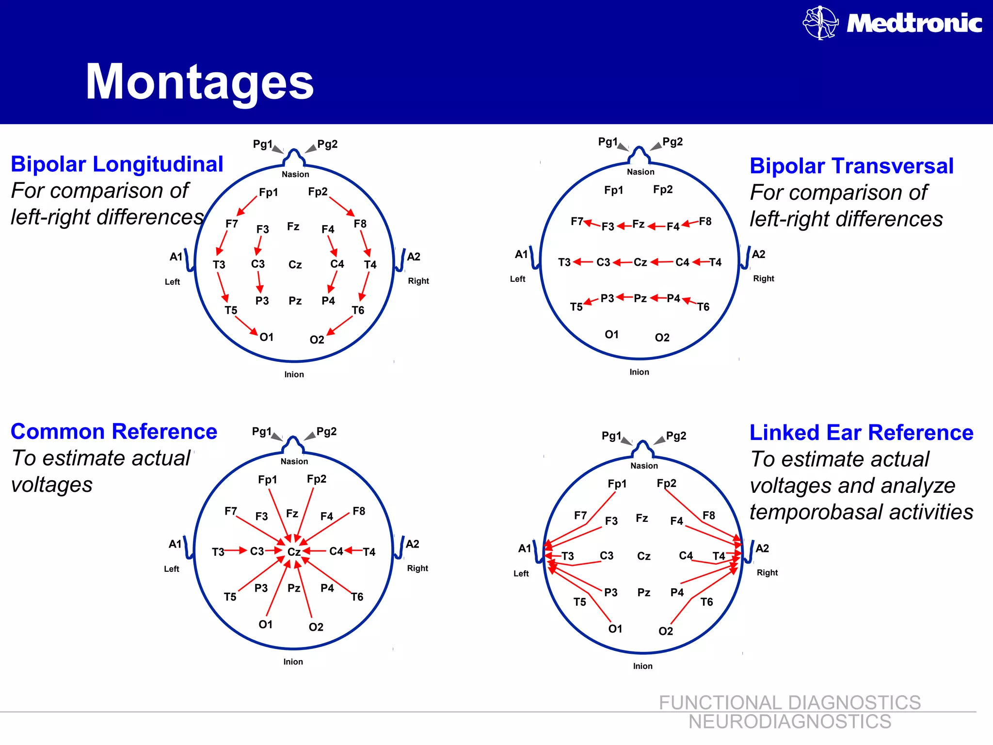 EEG ~ Dr. Tarek Asaad | PPT