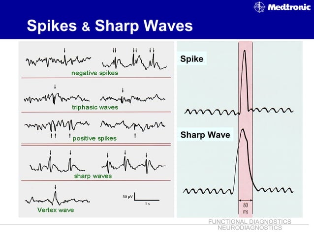 EEG ~ Dr. Tarek Asaad | PPT