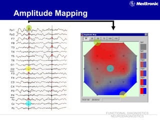 EEG ~ Dr. Tarek Asaad | PPT