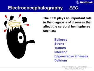 EEG ~ Dr. Tarek Asaad | PPT