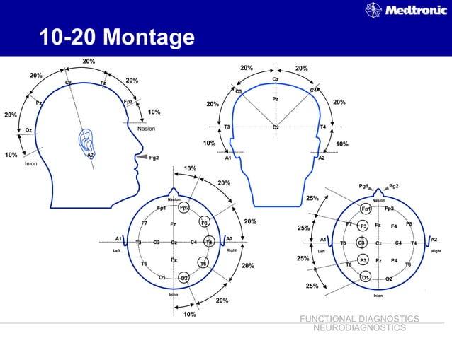 EEG ~ Dr. Tarek Asaad | PPT