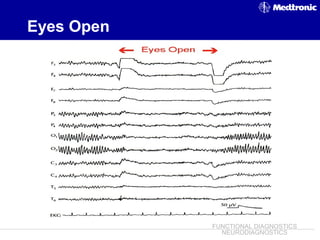 EEG ~ Dr. Tarek Asaad | PPT