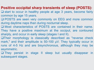 Positive occipital sharp transients of sleep (POSTS):
 start to occur in healthy people at age 3 years, become fairly
common by age 15 years.
 POSTS are seen very commonly on EEG and more common
during daytime naps than during nocturnal sleep.
 Most characteristics of POSTS are contained in their name.
They have a positive maximum at the occiput, are contoured
sharply, and occur in early sleep (stages I and II).
Their morphology is classically described as "reverse check
mark," and their amplitude is 50-100 µV. They typically occur in
runs of 4-5 Hz and are bisynchronous, although they may be
asymmetric.
 They persist in stage II sleep but usually disappear in
subsequent stages.
 