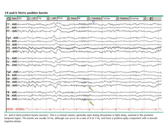 Eeg basics, part 1