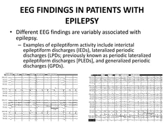 EEG FINDINGS IN PATIENTS WITH
EPILEPSY
• Different EEG findings are variably associated with
epilepsy.
– Examples of epileptiform activity include interictal
epileptiform discharges (IEDs), lateralized periodic
discharges (LPDs; previously known as periodic lateralized
epileptiform discharges [PLEDs], and generalized periodic
discharges (GPDs).
 