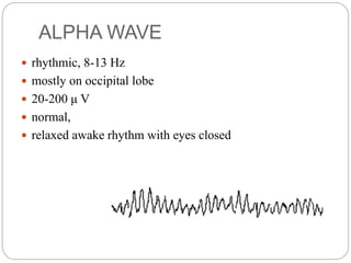 EEG.pptx