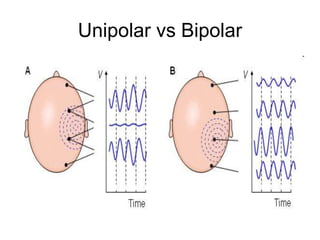 EEG.ppt