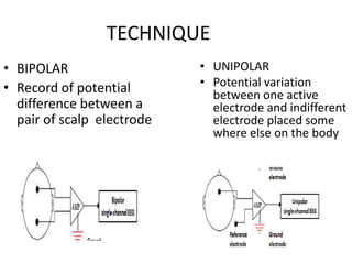 PHYSIOLOGY OF EEG AND ITS APPLIED ASPECT.pptx