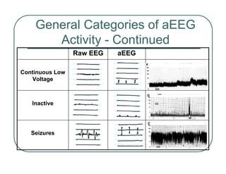 General Categories of aEEG
Activity - Continued
Seizures
Inactive
Continuous Low
Voltage
aEEG
Raw EEG
 
