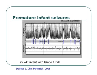 Premature infant seizures
25 wk. infant with Grade 4 IVH
25 wk. infant with Grade 4 IVH
DeVries
DeVries L, Clin. Perinatol., 2006
L, Clin. Perinatol., 2006
 