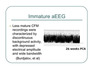 Immature aEEG
z Less mature CFM
recordings were
characterized by
discontinuous
background activity,
with depressed
electrical amplitude
and wide bandwidth
(Burdjalov, et al)
26 weeks PCA
26 weeks PCA
 