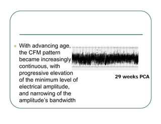z With advancing age,
the CFM pattern
became increasingly
continuous, with
progressive elevation
of the minimum level of
electrical amplitude,
and narrowing of the
amplitude’s bandwidth
29 weeks PCA
29 weeks PCA
 