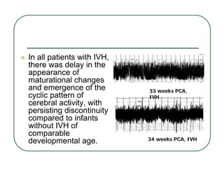 z In all patients with IVH,
there was delay in the
appearance of
maturational changes
and emergence of the
cyclic pattern of
cerebral activity, with
persisting discontinuity
compared to infants
without IVH of
comparable
developmental age. 34 weeks PCA, IVH
34 weeks PCA, IVH
33 weeks PCA,
33 weeks PCA,
IVH
IVH
 