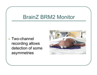 BrainZ BRM2 Monitor
z Two-channel
recording allows
detection of some
asymmetries
 