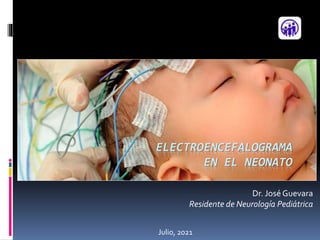 Dr. JoséGuevara
Residente de Neurología Pediátrica
ELECTROENCEFALOGRAMA
EN EL NEONATO
Julio, 2021
 