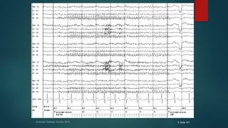 American Epilepsy Society 2015 E Slide 101
Q 5
Q 5
 