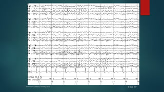 American Epilepsy Society 2015 E Slide 107
 