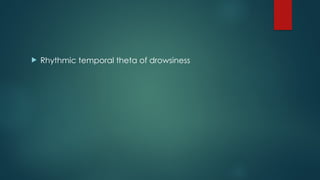  Rhythmic temporal theta of drowsiness
 