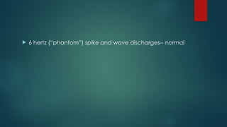  6 hertz (“phantom”) spike and wave discharges-- normal
 